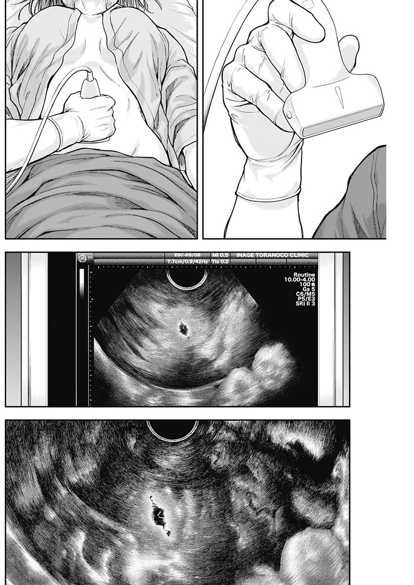 Page 8 of Chapter 62